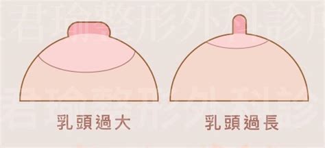 乳暈生毛